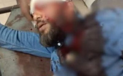 এনসিপি নেতা গুলিবিদ্ধের ঘটনায় সন্দেহভাজন নারী আটক
