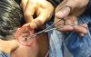 প্রাথমিক শিক্ষক নিয়োগ: পরীক্ষা চলাকালে অনেকের কানে মিললো ডিভাইস, আটক ৫২
