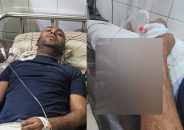 শাহবাগে পুলিশের হামলায় গুরুতর আহত এমপি প্রার্থী