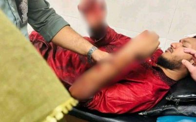 নামাজঘরের পাশে মাদক-জুয়া, প্রতিবাদ করায় কৃষকদল নেতার হামলায় বিশ্ববিদ্যালয় ছাত্র রক্তাক্ত