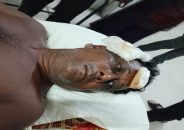 খুলনায় বিএনপি নেতাকে গুলি